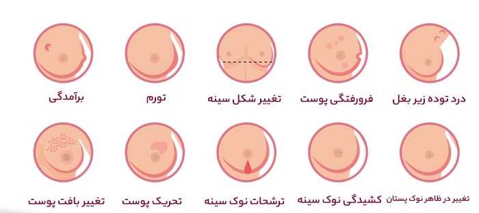 درمان سرطان سینه